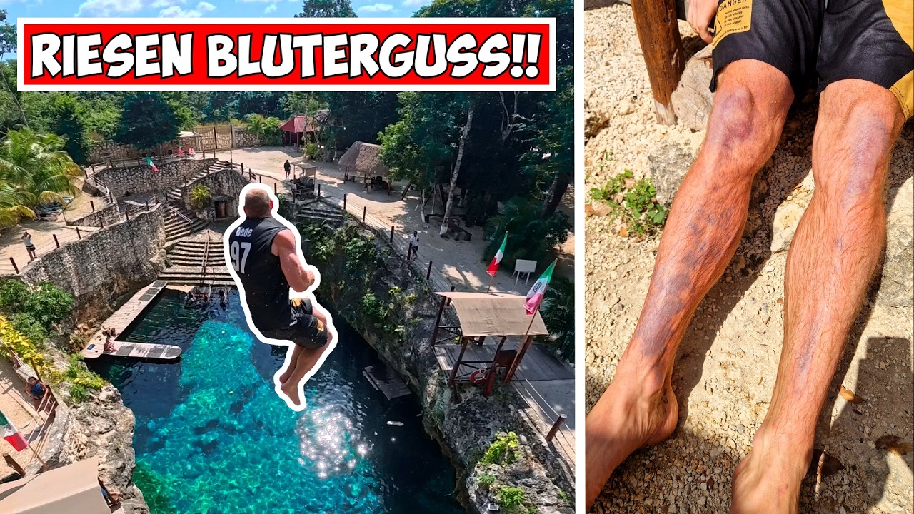BRUTALER FAIL nimmt mich KOMPLETT auseinander! 4-Fach Salto GEHT SCHIEF! Mexico pt. 6
