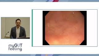 My Gut Feeling 2026 Stomach Conference - Dr Jeffrey Mosko