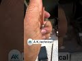 aluminium ke pipe per Brazing #refrigeration #automobile #brazing #welding #adorwelding #arcwelding