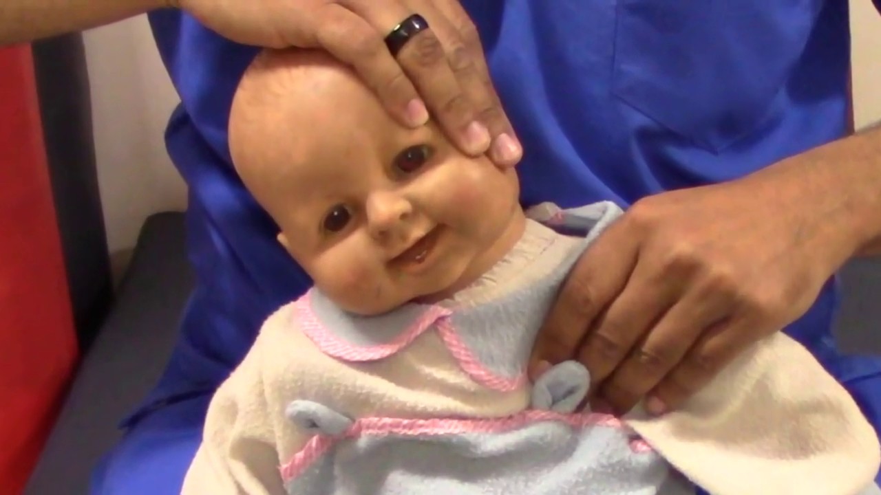 08- Congenital muscular torticollis: Intervention (Stretching)