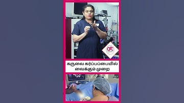 Embryo Transfer Procedure Shorts | ARC Fertility Centre| ARC Fertility Hospitals