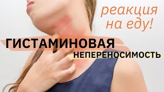 Гастроэнтеролог о гистаминовой непереносимости