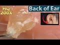 Back of Ear Blackhead Removal HQ200X | 耳の裏の角栓をピンセットで抜く HQ200倍