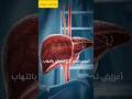 أعراض تشير إلى إصابتك بالتهاب الكبد Viralvideo اكسبلور Viralshort Video أعراض تشير إلى إصابتك بالتهاب الكبد Viralvideo اكسبلور Viralshort Video