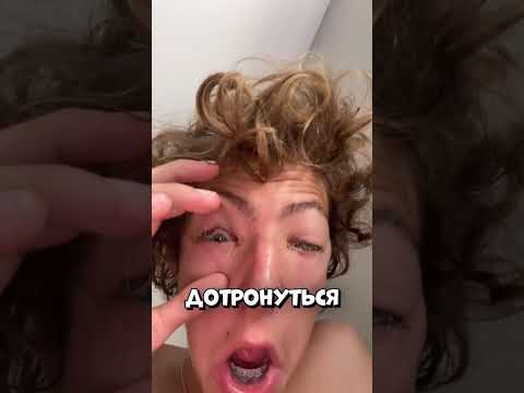 Паника началась, когда он открыл глаза и увидел… ничего #shorts