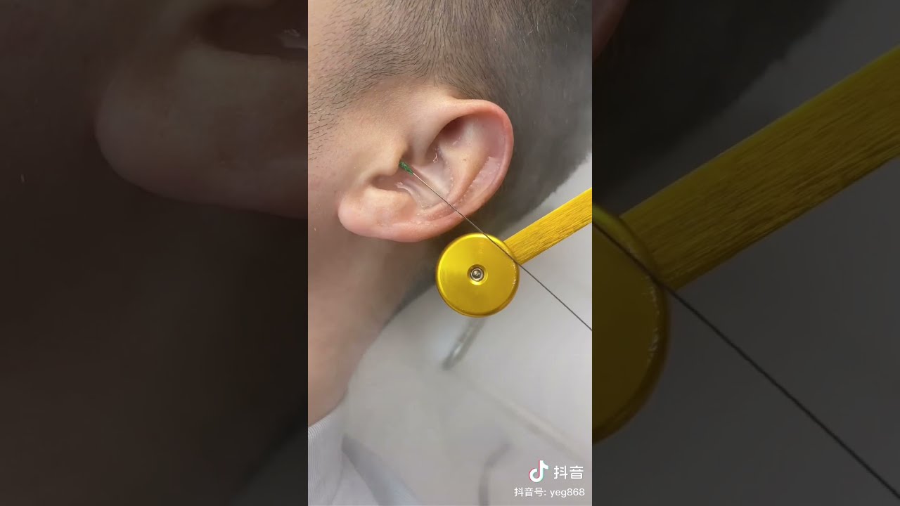 ASMR. Ear cleaning tik tok china 耳掃除 [ なんでこんなに汚いんだー !! ] Ep.17 YouTube