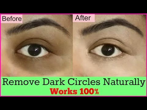 how-to-remove-dark-circles-at-home-permanently-|-डार्क-सर्कल्स-हमेशा-के-लिए-कैसे-हटाए