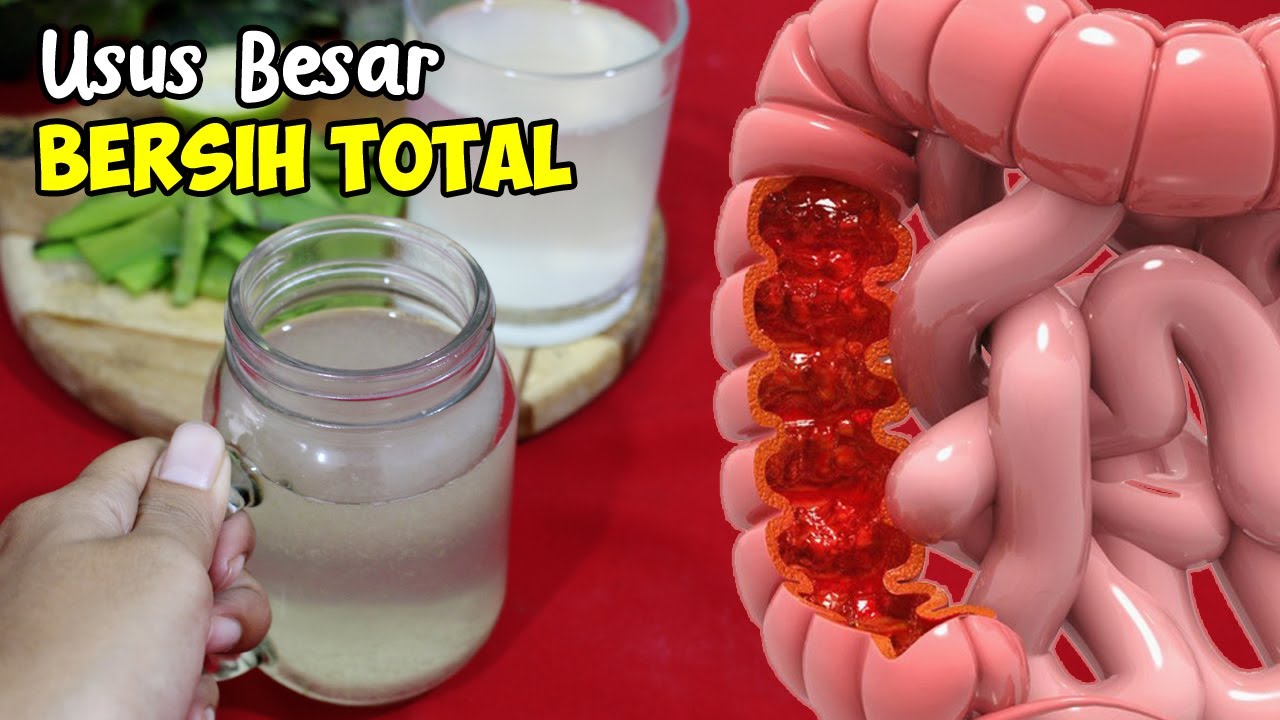 2 CARA MEMBERSIHKAN USUS KOTOR SECARA ALAMI | USUS BERSIH TOTAL