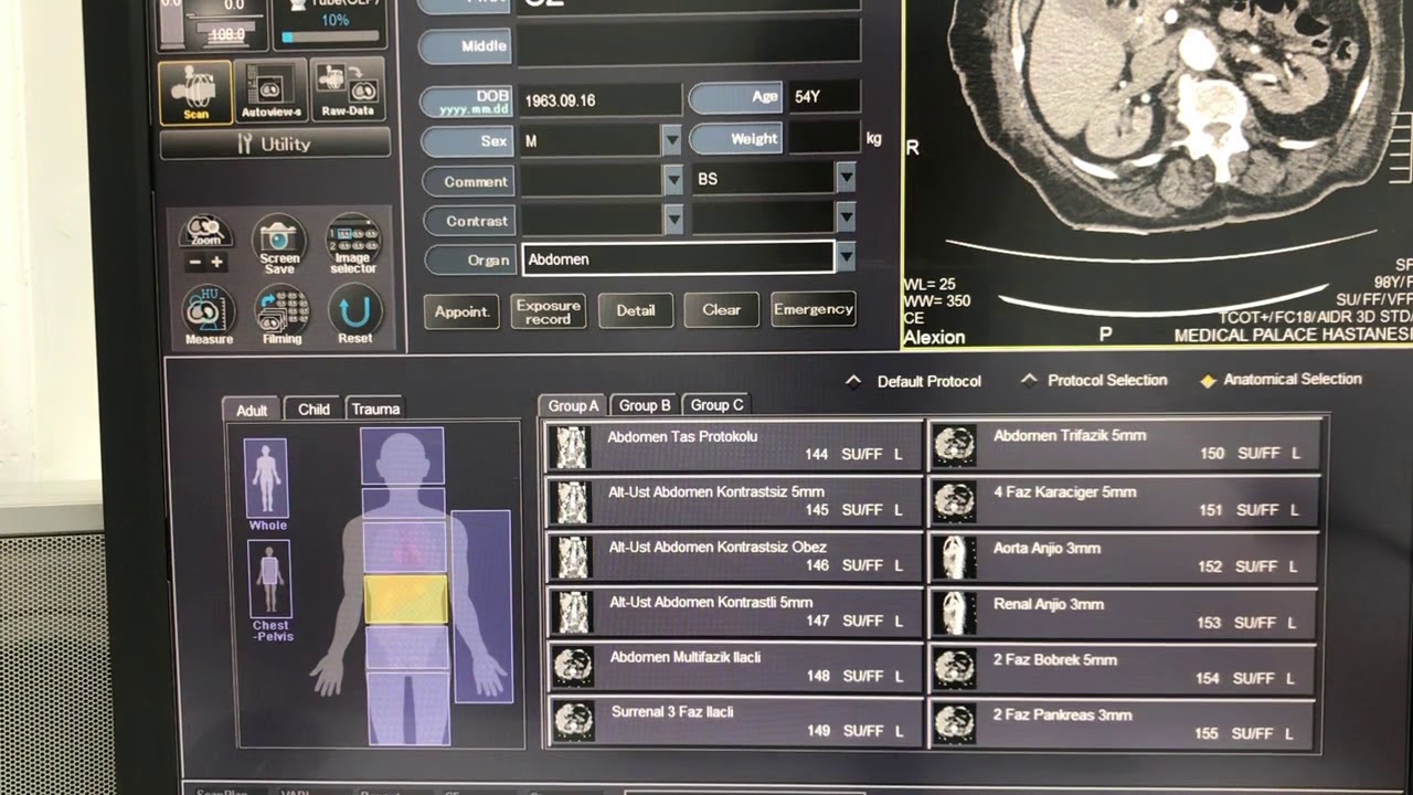 Alt Üst Abdomen Kontrastli Tomografi Cekimi Nasil Yapilir?Bi Fazik Oral Suspansiyonsuz İncelemesi