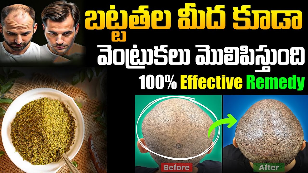 30 రోజులు నేను ట్రై చేసిన Secret || Lifeless Hair కి ఇది నిజంగా సంజీవిని || Hair Growth Miracle