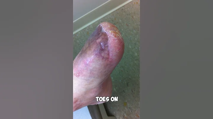 What Happened to these TOES?!? 🤣🤯 #shorts