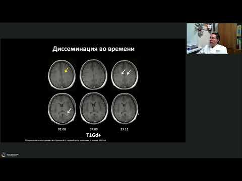 Вебинар МРО РОРР: МРТ- диагностика при рассеянном склерозе в дебюте и в динамике