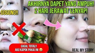 ES BATU UNTUK WAJAH?! | BENER GA SIH BISA HILANGIN KOMEDO DAN JERAWAT