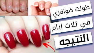 اقوي طريقه لتطويل الاظافر في 3 ايام/ طريقه غير مكلفه