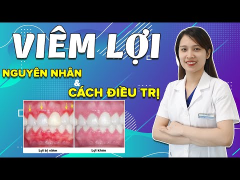 vệ sinh răng miệng tại nha khoa tại Kemtrinam.vn