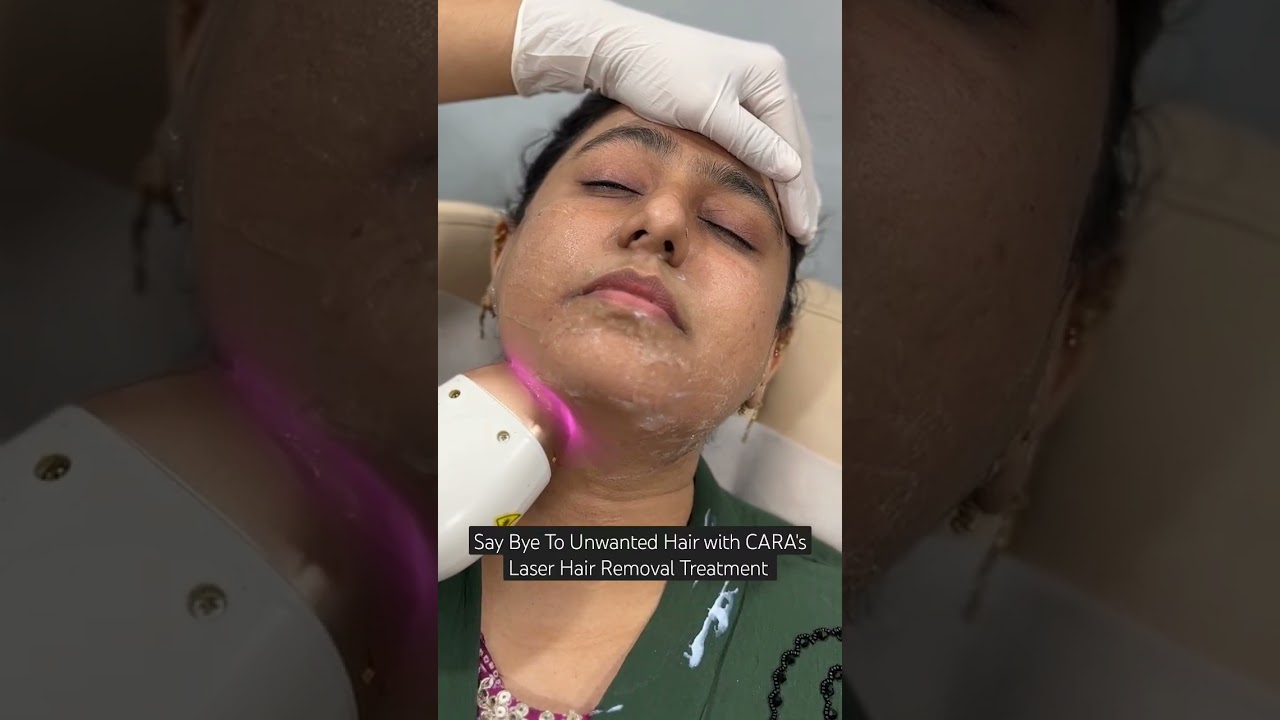 Unwanted Hair Solution with  CARA’s Laser Hair Removal Treatment