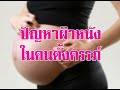 คุยกับ นพ.สมนึก อมรสิริพาณิชย์ เรื่องปัญหาผิวหนังในคนตั้งครรภ์