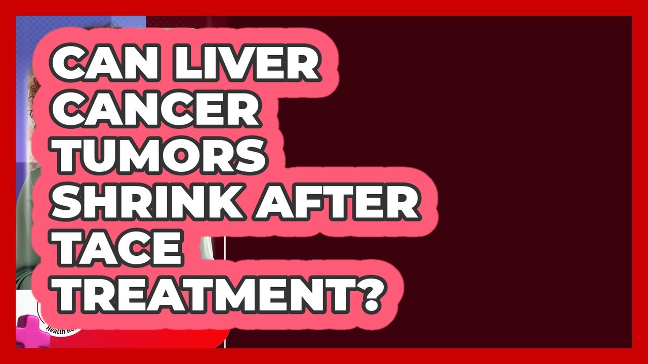 Can Liver Cancer Tumors Shrink After TACE Treatment? - Liver Health Hub