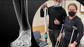 Patient's opinion after rehabilitation with Smart Crutch Tips