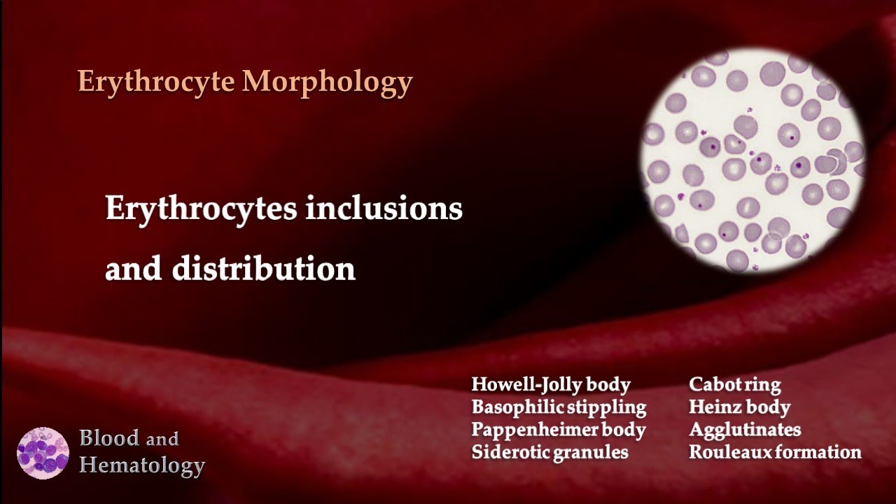 Erythrocyte morphology: Erythrocytes inclusions and distribution