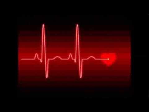 Video: Quale dovrebbe essere il battito cardiaco fetale a 12 settimane?