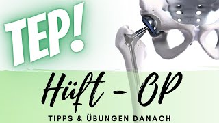 Hüft-OP: Übungen und Tipps (Künstliches Hüftgelenk / Hüft-TEP / Reha / Übungen für Zuhause)