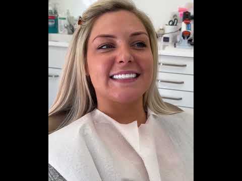 Rhanne's Review Of Zirconium Crowns And Before x After!
