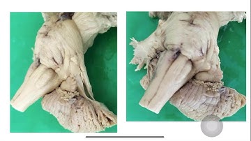 Dr. Pratheepa’s tutorial- cerebellum