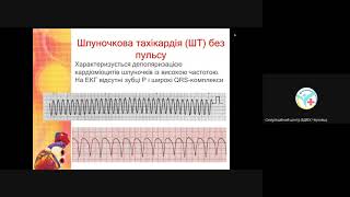 Види зупинки кровообігу. Теорія та практика роботи з дефібрилятором