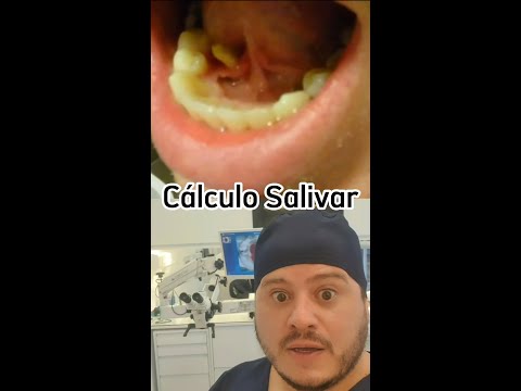 Vídeo: Quem é o criador da boca grande?