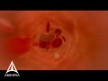 Amerra 3d medical visualization  demo trailer 2009