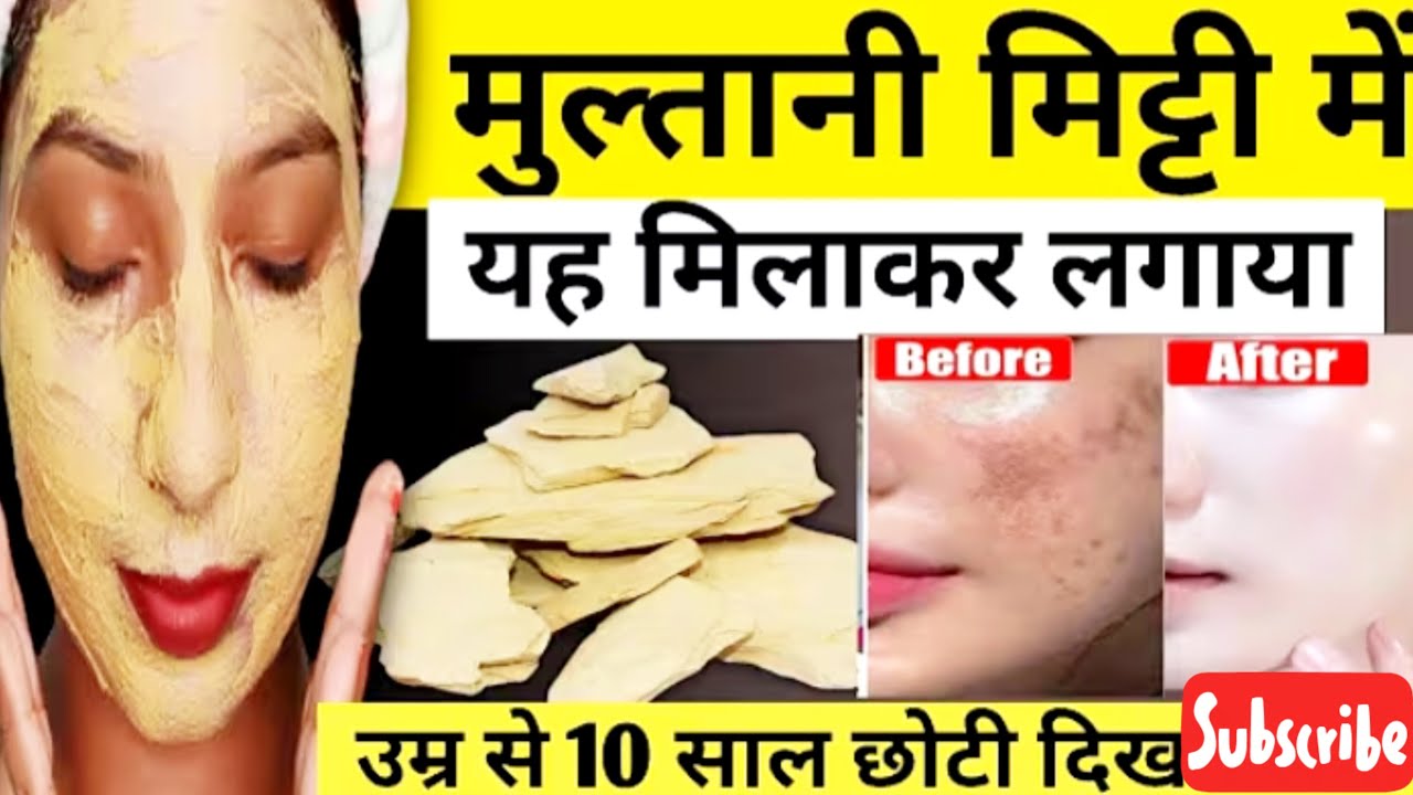 मुल्तानी मिट्टी में सिर्फ यहचीज लगालगाआपकाफेस पर टैनिंग पिगमेंटेशन है पिंपल सारे एकदम क्लियरकर देगा