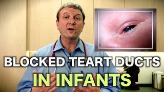 Blocked Tear Ducts In Infants Pediatric Advice