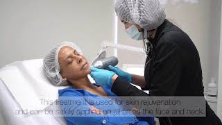 Pixel Rf 8 Advanced Micro-Needling