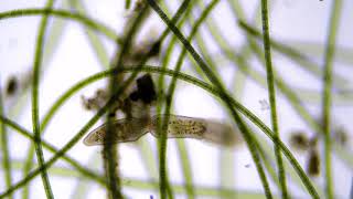 Amscope Microscope Camera (Freshwater Worm)