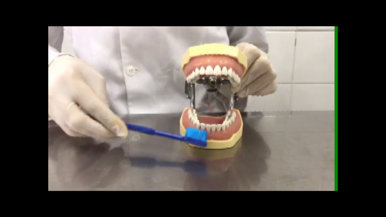 Técnica de Charters - odontologia 3º período uninovafapi - YouTube