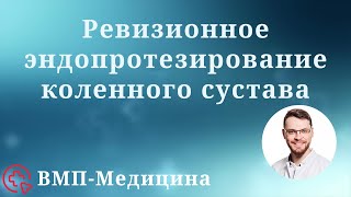 Ревизионное эндопротезирование коленного сустава | ВМП-Медицина