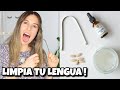 CANDIDIASIS BUCAL y MAL ALIENTO I Mis remedios naturales + consejos