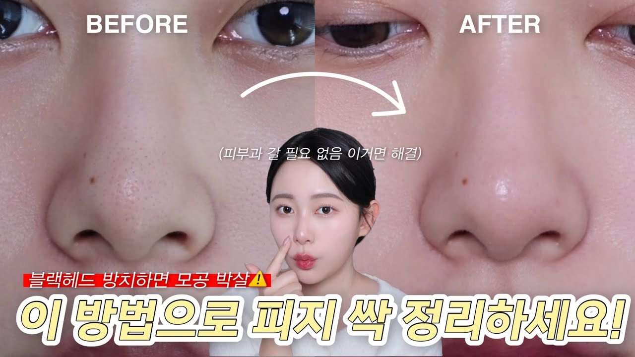 이 방법 모르면 피지 쌓입니다..⚠️ 지금 해야 할 블랙헤드, 피지 관리법 공개‼️ (피부과 갈 필요없는 해결법 공개 ...