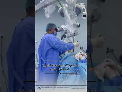 بالتداخل المجهري و بدون تثبيت براغي توسيع لتضيق القناة الشوكية