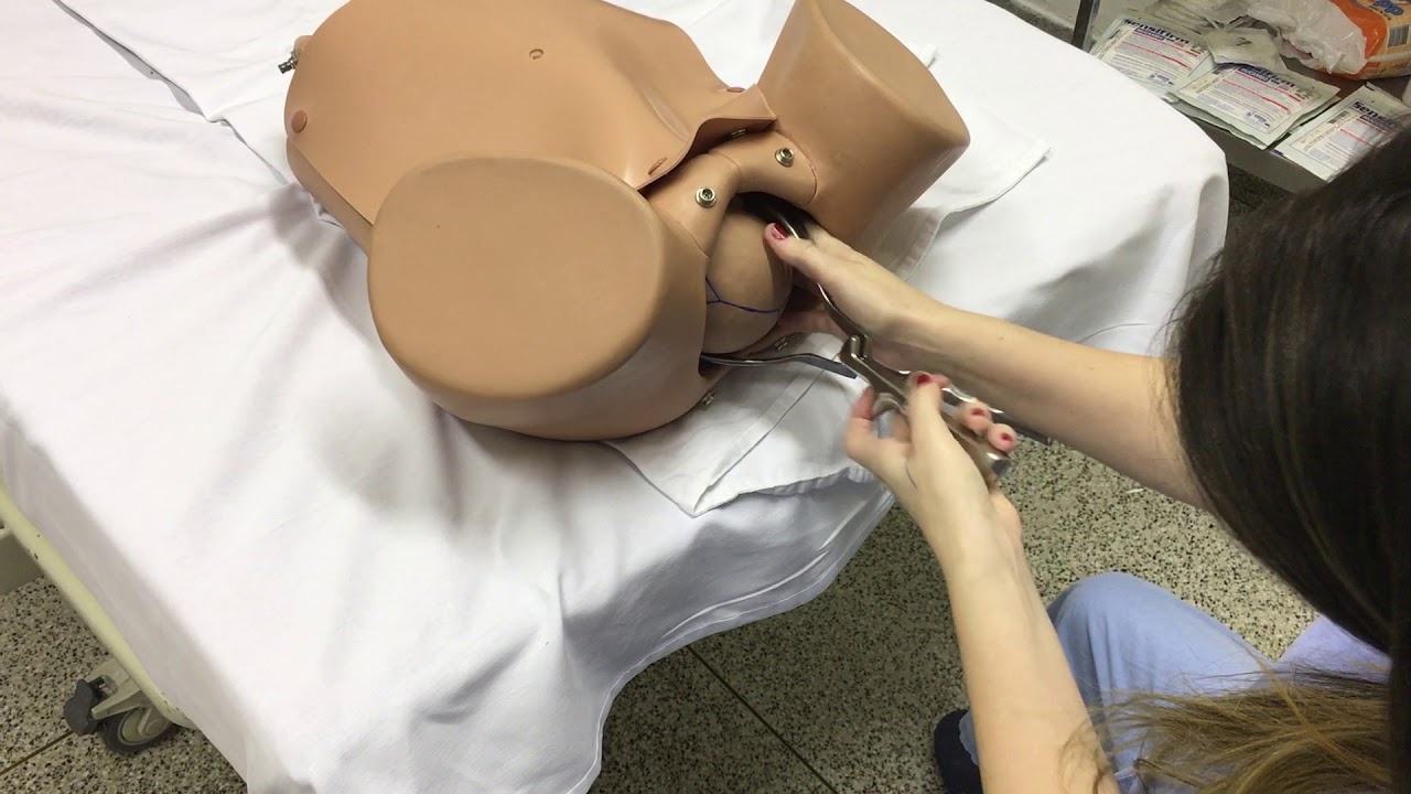 Técnica de aplicação do fórcipe de Simpson em ODA