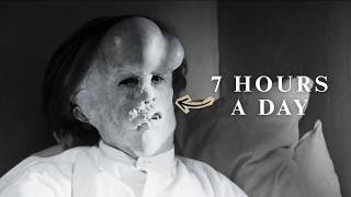 How The Elephant Man Changed Makeup Forever