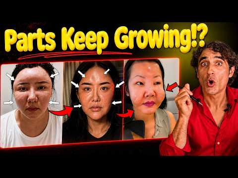 Bubble Face // The Deadly Growth Factor Trend !!