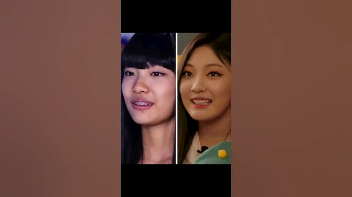 NINGNING AESPA did PLASTIC SURGERY? 🤔🤔😳 #kpop