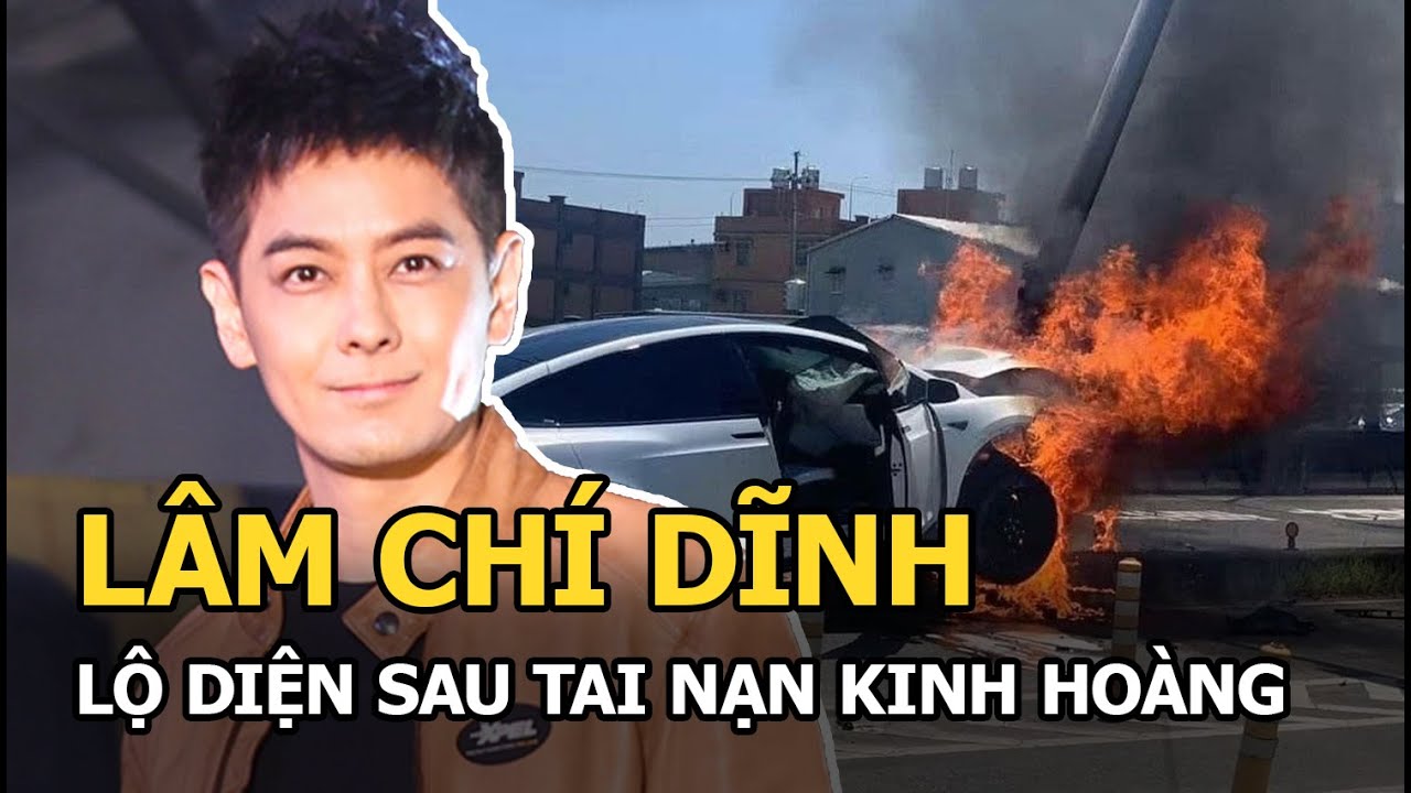 Lâm Chí Dĩnh trải qua phẫu thuật xương mặt, bà xã động... - youtube