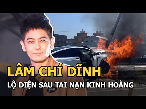 Video Lâm Chí Dĩnh trải qua phẫu thuật xương mặt, bà xã động... - youtube