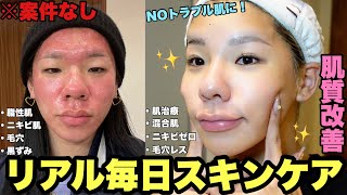 【垢抜け】ニキビ肌からNOトラブル肌になったリアル毎日スキンケアを案件なしで全部見せ！【スキンケア編】