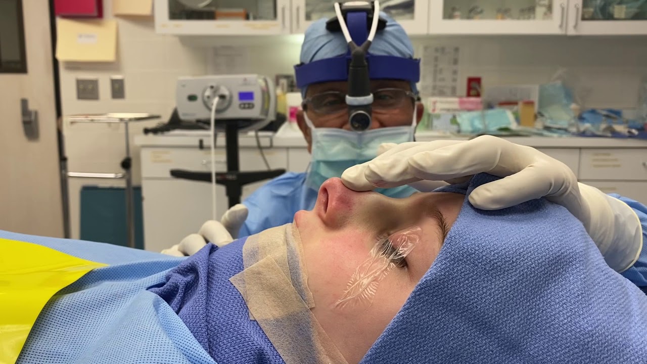 A Nose Job (Rhinoplasty) What Goes On Behind Closed Doors YouTube