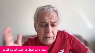 مجزره غير شكل في قلب العروبه النابض