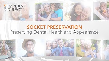 Socket Preservation - Preserving Dental Health and Appearance